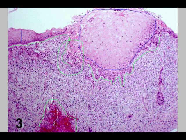 الملابس الصيفية
