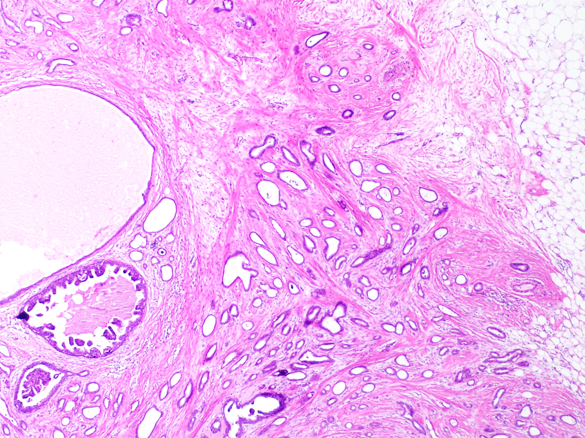 حقيبة ظهر VG8J