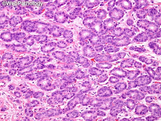 حذاء رياضي D5J0