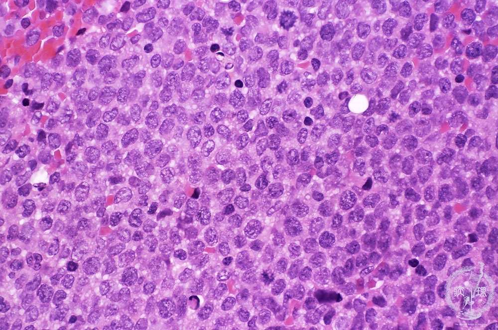 حقيبة ظهر WIKV